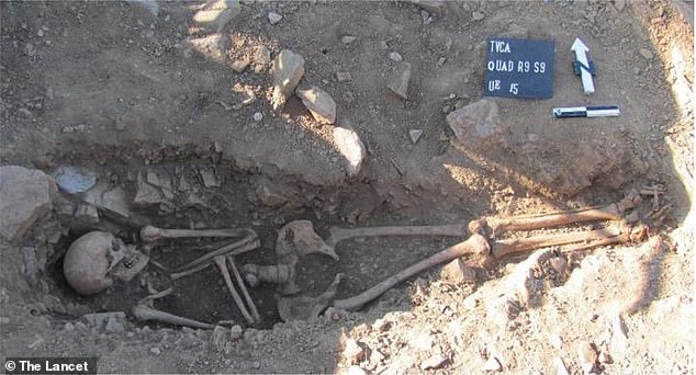 1,000 年前の骨格は、ポルトガルの楕円形の墓で発見されました。 チームは遺体から DNA を抽出し、その男性がクラインフェルター症候群であったことを明らかにしました。 余分なX染色体がある場合に起こる